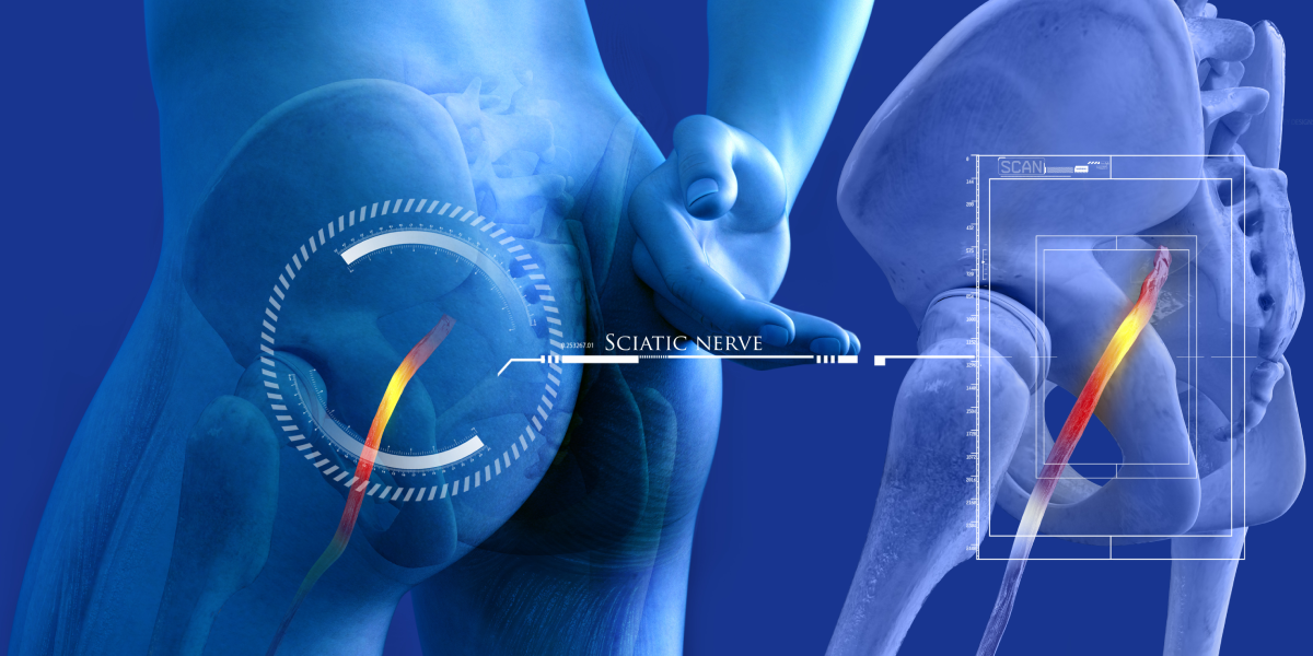 Sciatic nerve